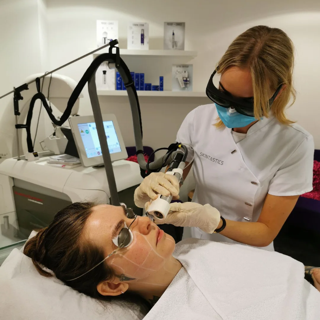 laser-ontharen-behandeling-gezicht-skintastics Huidtherapeut voert laserontharing uit op het gezicht bij Skintastics Rotterdam